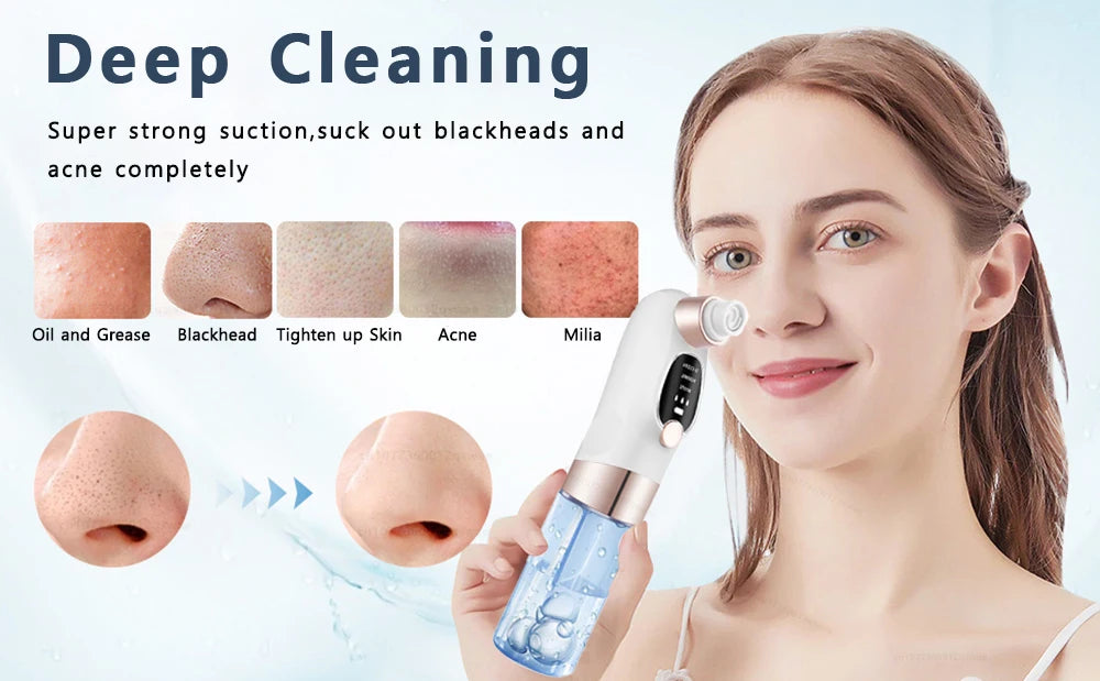 Blackhead Remover Pore Vacuum Face Cleaner Electric Pimple Acne Black Head Removal USB Rechargeable Water Cycle Black Dot Remove