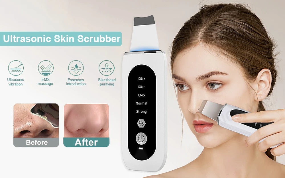 Ultrasonic Skin Scrubber Peeling Blackhead Remover Deep Face Cleaning Ultrasonic Ion Ance Pore Cleaner Facial Shovel Cleanser