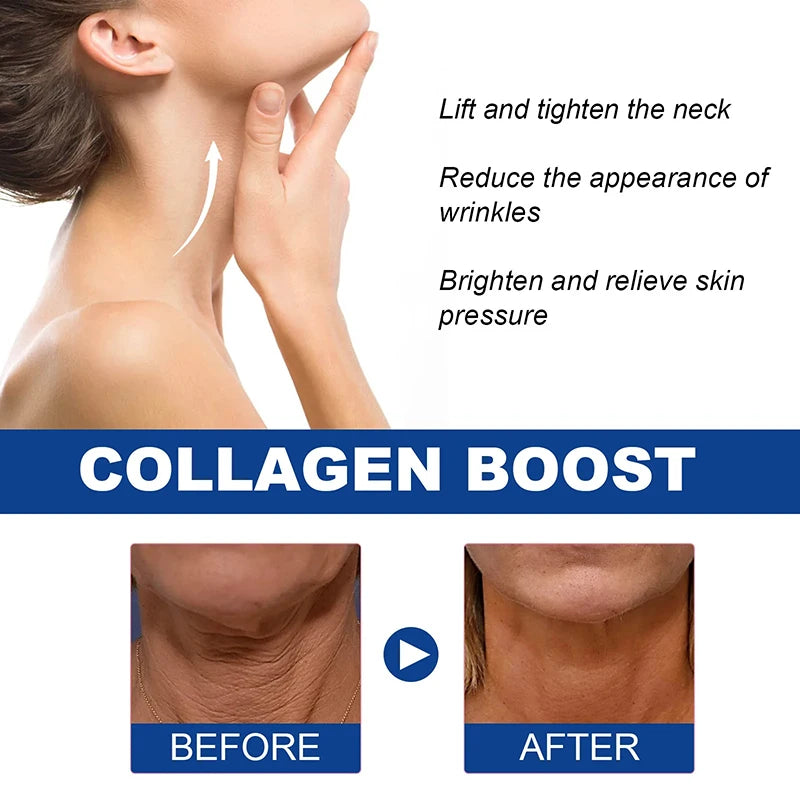 Collagen Neck Cream Anti-aging Tightening Lifting Whitening Moisturizing For Neck Double Chin Reduce Fine Line Skin Care Product