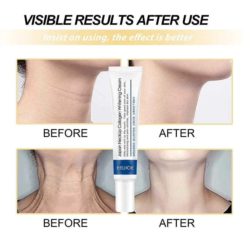 Collagen Neck Cream Anti-aging Tightening Lifting Whitening Moisturizing For Neck Double Chin Reduce Fine Line Skin Care Product