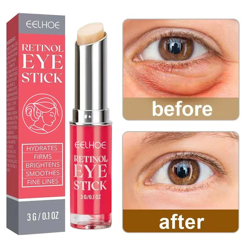 Anti-Wrinkle Eye Cream Retinol Remove Eye Bags Dark Circles Anti Aging Lifting Firming Whitening Moisturizing Brighten Skin Care